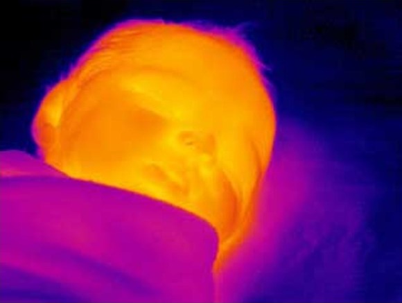 fever detection thermal camera